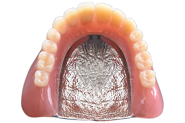 コバルトクロム床